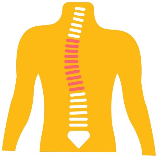 Scoliosis-Chiropractor-min